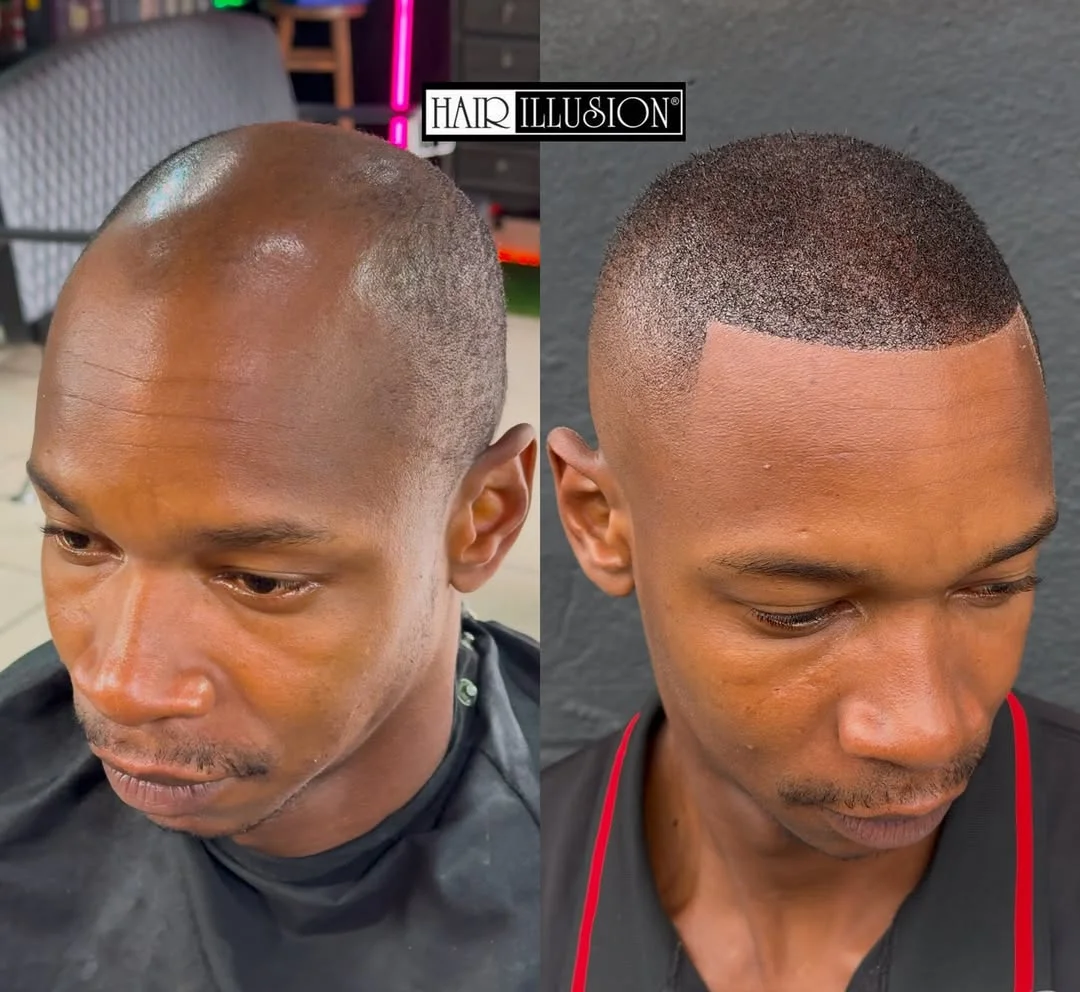 Before and after 4