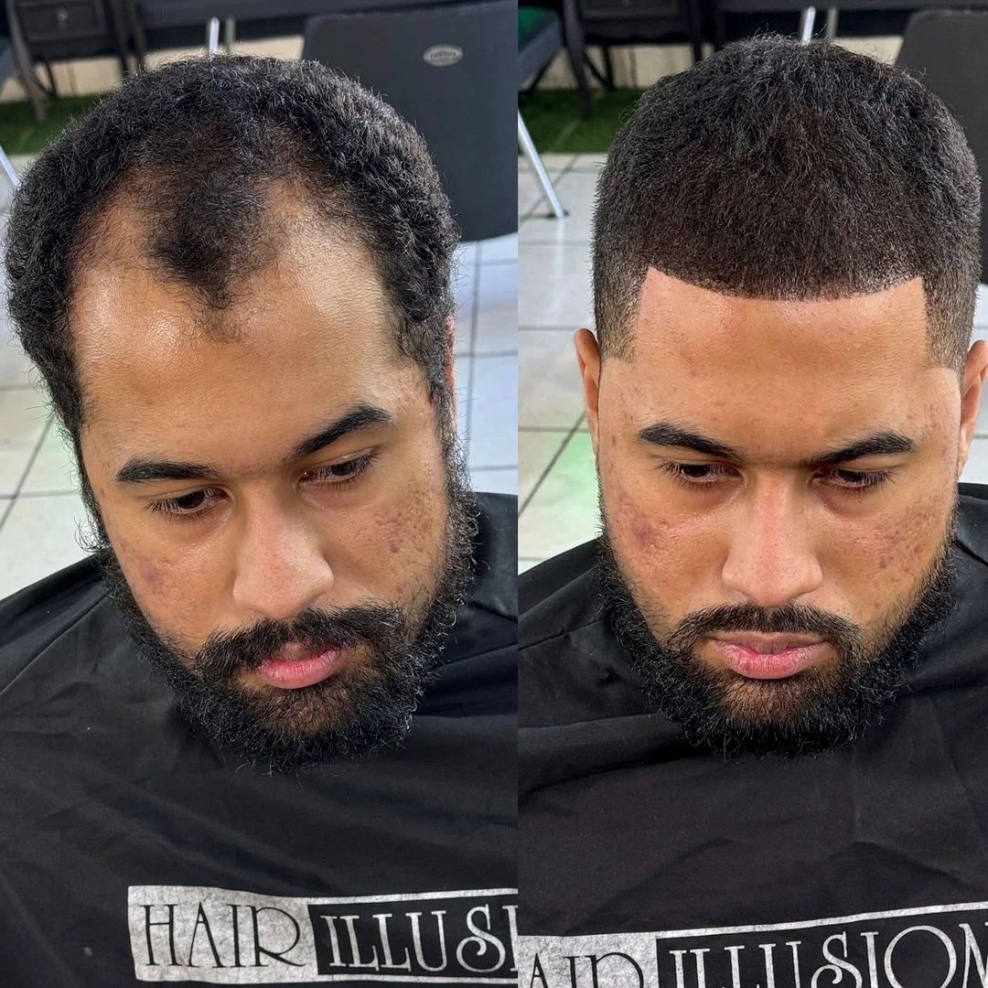 Before and after 7