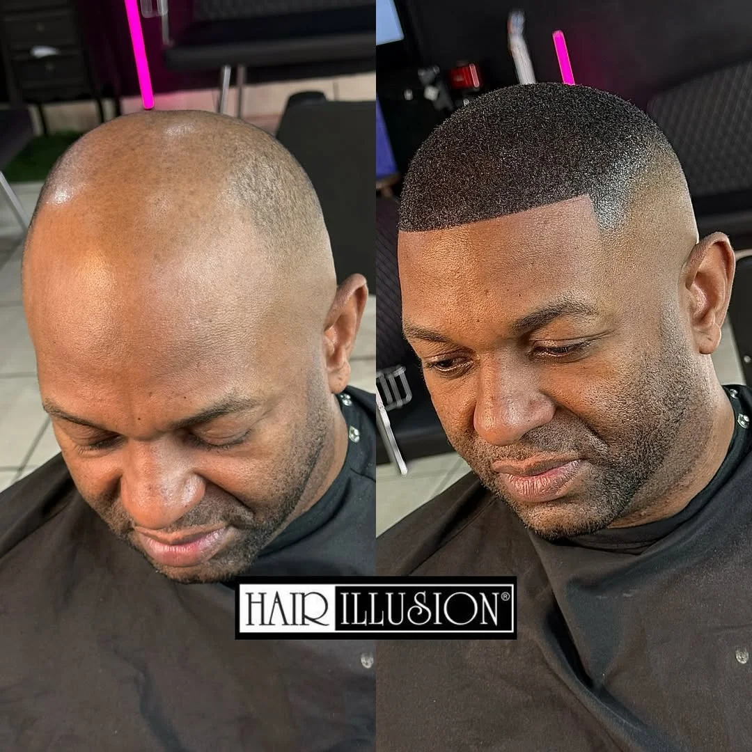 Before and after 1